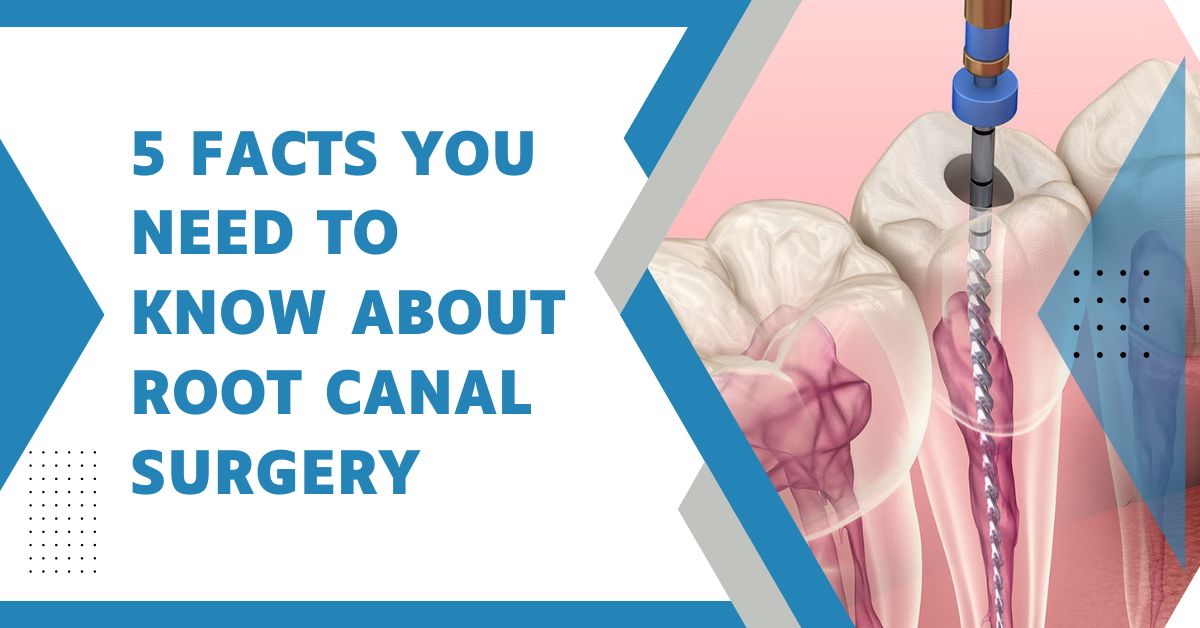root canal surgery